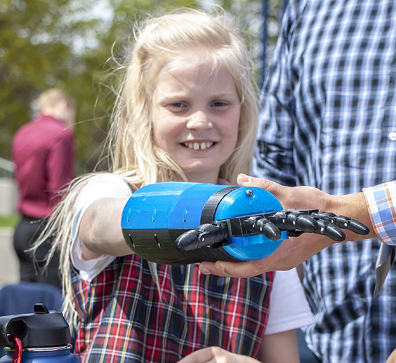 girl tries on prosthetic hand