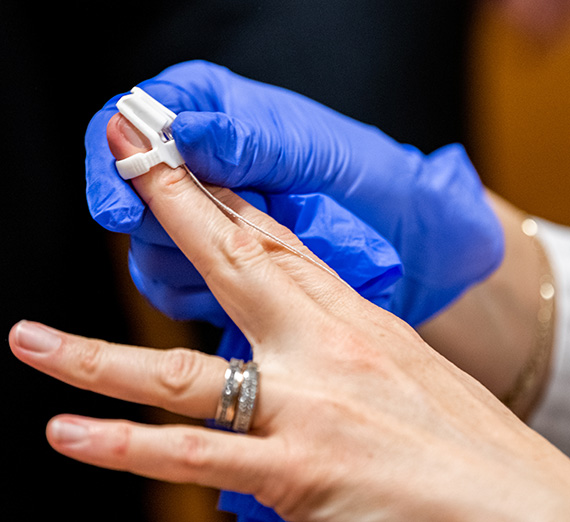 A hand with a blue medical glove holds a medical device on another hand.