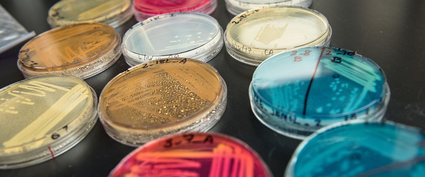 Close up of petri dishes